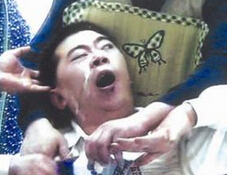 患癫痫会出现哪些症状